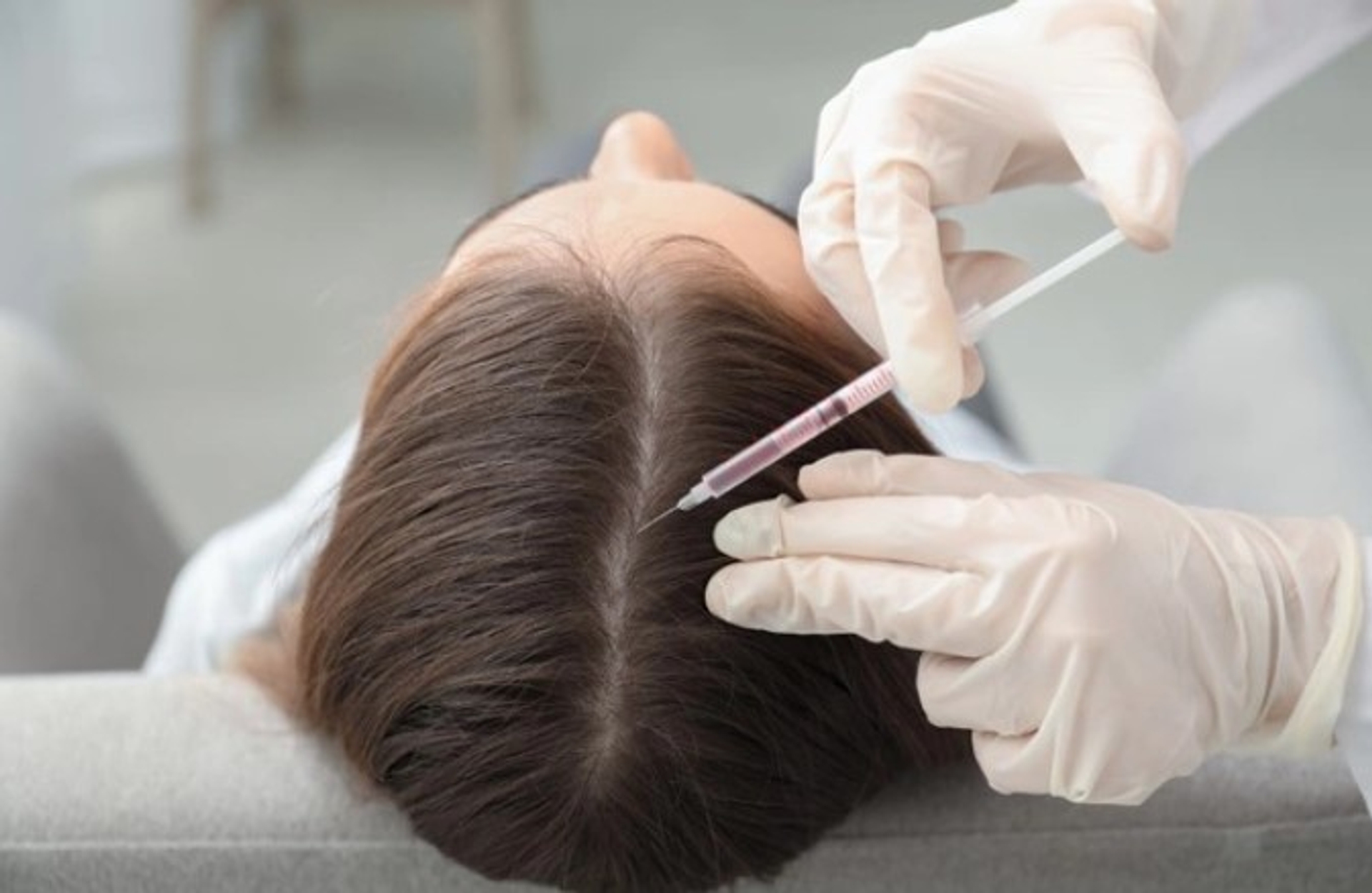 Female Hair Transplantation thumbnail