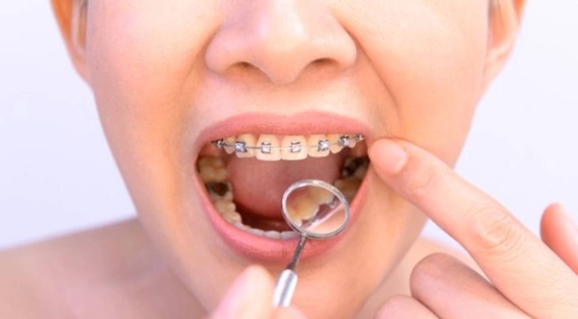 Dental Esthetic and Treatments