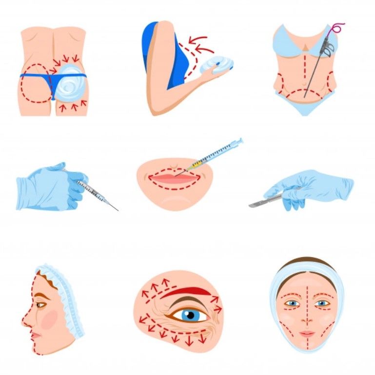 estefulya - plastic surgery