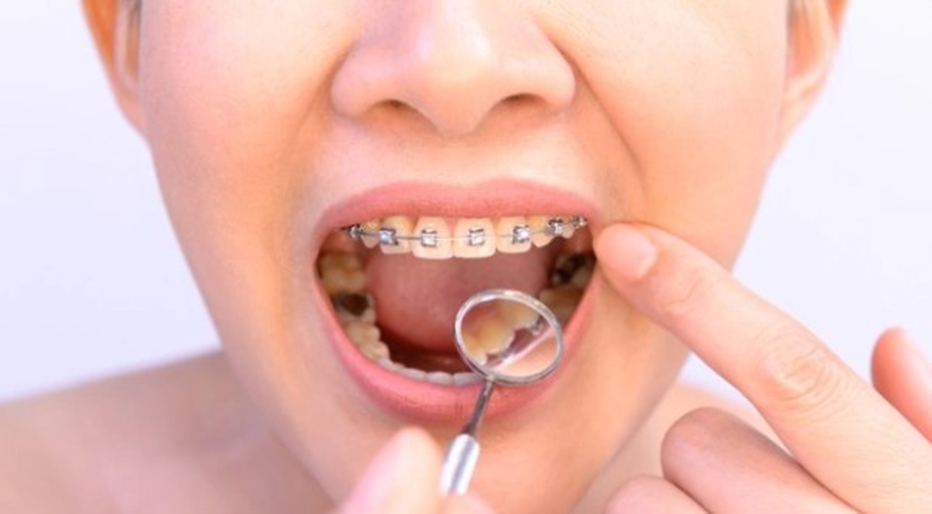 Dental Esthetic and Treatments thumbnail